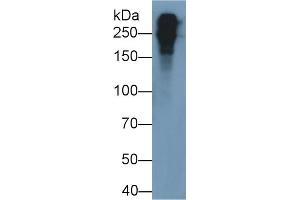 Detection of FN in Mouse Plasma using Polyclonal Antibody to Fibronectin (FN) (Fibronectin antibody  (AA 2117-2236))