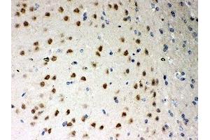 IHC-P: PKC iota antibody testing of mouse brain tissue (PKC iota antibody  (AA 21-214))