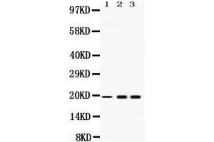 Western blot analysis of PC4 expression in rat liver extract ( Lane 1), HELA whole cell lysates ( Lane 2) and U2OS whole cell lysates ( Lane 3). (SUB1 antibody  (C-Term))
