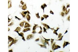 ICC testing of PDK2 antbody and HeLa cells (PDK2 antibody  (C-Term))
