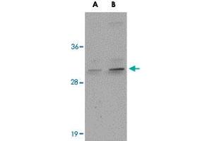 Western blot analysis of CENPO in mouse kidney tissue lysate with CENPO polyclonal antibody  at (A) 1 and (B) 2 ug/mL . (CENPO antibody  (Internal Region))