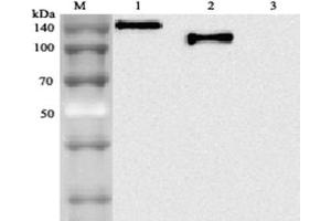 Western blot analysis using anti-ACE2 (human), mAb (AC18F) (Biotin)  at 1: 2,000 dilution. (ACE2 antibody  (Biotin))