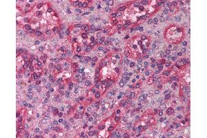 Anti-LHX1 antibody IHC of human spleen. (LHX1 antibody  (AA 120-169))