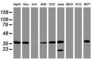 Image no. 2 for anti-Apurinic/Apyrimidinic Endonuclease 1 (APEX1) (AA 1-242) antibody (ABIN1490625) (APEX1 antibody  (AA 1-242))