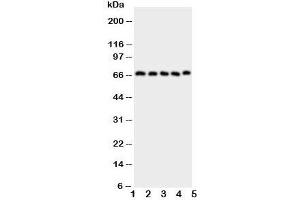 Western blot testing of COX2 antibody and Lane 1:  human placenta;  2: COLO320;  3: HeLa;  4: PANC;  5: SKOV cell lysate. (COX2 antibody  (AA 589-604))