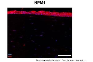Sample Type: human cornea (frozen)Blue: DAPIRed: NPM1Primary Dilution: 1:100Image Submitted By: Geraint ParfittGavin Herbert Eye Institute . (NPM1 antibody  (Middle Region))