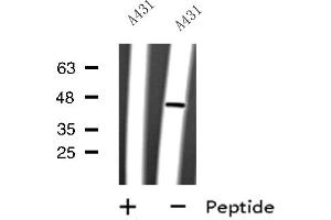 Western blot analysis of CYLC2 expression in A431 whole cell lysate ,The lane on the left is treated with the antigen-specific peptide. (CYLC2 antibody  (C-Term))