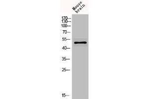 Western Blot analysis of MOUSE-BRAIN cells using GABAA Rα6 Polyclonal Antibody (GABRA6 antibody  (Internal Region))