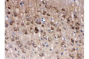 Anti- PGP9. (UCHL1 antibody  (C-Term))