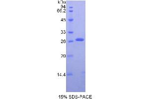SDS-PAGE (SDS) image for Transferrin Receptor (p90, CD71) (TFRC) (AA 567-744) protein (His tag) (ABIN1080994)