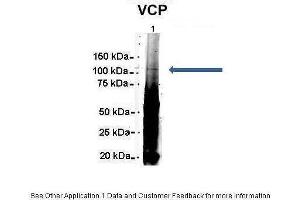 Amount and Sample Type : 500 ug Human NT2 cell lysate Amount of IP Antibody : 6 ug Primary Antibody : VCP Primary Antibody Dilution : 1:500 Secondary Antibody : Goat anti-rabbit Alexa-Fluor 594 Secondary Antibody Dilution : 1:5000 Gene Name : VCP Submitted by : Dr. (VCP antibody  (C-Term))
