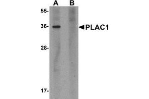 Western blot analysis of PLAC1 in human placenta tissue lysate with PLAC1 antibody at 1 μg/ml in (A) the absence and (B) the presence of blocking peptide. (PLAC1 antibody  (C-Term))