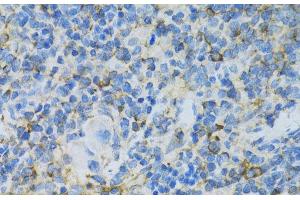 Immunohistochemistry (Paraffin-embedded Sections) (IHC (p)) image for anti-Ribosomal Protein L13 (RPL13) antibody (ABIN7260958)