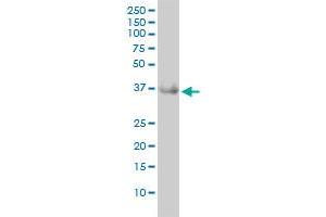 GRHPR monoclonal antibody (M01), clone 4E6-1F2 Western Blot analysis of GRHPR expression in MCF-7 . (GRHPR antibody  (AA 1-328))