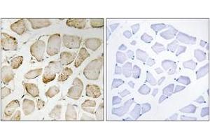 Immunohistochemistry analysis of paraffin-embedded human skeletal muscle tissue, using Arachidonate 5 Lipoxygenase (Ab-271) Antibody.