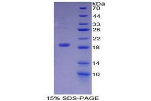 SDS-PAGE (SDS) image for Dermcidin (DCD) (AA 18-110) protein (His tag) (ABIN2120952) (Dermcidin Protein (DCD) (AA 18-110) (His tag))