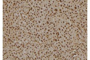ABIN6277130 at 1/100 staining Mouse liver tissue by IHC-P. (SCCPDH antibody)