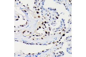 Immunohistochemistry (IHC) image for anti-Cyclin D1 (CCND1) antibody (ABIN7266561)