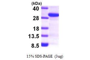 SDS-PAGE (SDS) image for SCAN Domain Containing 1 (SCAND1) (AA 1-179) protein (His tag) (ABIN667831)