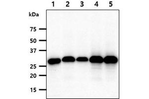 The cell lysates(40ug) were resolved by SDS-PAGE, transferred to PVDF membrane and probed with anti-human FHL2 antibody (1:1000). (FHL2 antibody)