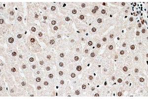 Immunohistochemistry of paraffin-embedded Rat liver using CBX6 Polyclonal Antibody at dilution of 1:100 (40x lens). (CBX6 antibody)