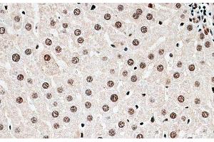 Immunohistochemistry of paraffin-embedded Rat liver using CBX6 Polyclonal Antibody at dilution of 1:100 (40x lens).