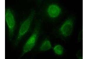 ODZ3 polyclonal antibody (Cat # PAB11565, 10 ug/mL) staining of nuclei HeLa cells (green). (TENM3 antibody)