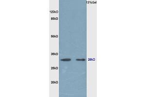 Rat lung lysates probed (ABIN679718) at 1:200 in 4 °C. (EPO antibody  (AA 101-193))