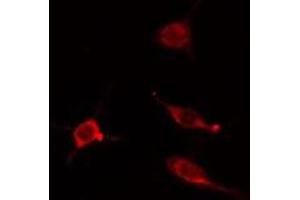 ABIN6275201 staining Hela cells by IF/ICC. (IQCB1 antibody  (Internal Region))