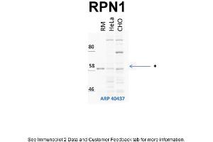 WB Suggested Anti-RPN1 Antibody Titration: 1 ug/mlPositive Control: HeLa and CHO-K1 cell lines, rouch canine microsomes (RPN1 antibody  (Middle Region))