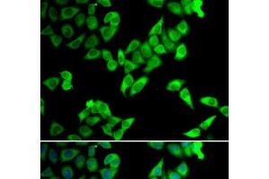 Immunofluorescence analysis of U2OS cells using TRIP10 Polyclonal Antibody (TRIP10 antibody)
