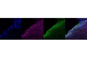 Immunohistochemistry (IHC) image for anti-Coiled-Coil Domain Containing 153 (CCDC153) antibody (ABIN7456187)