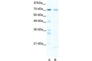Western Blotting (WB) image for anti-SRY (Sex Determining Region Y)-Box 13 (SOX13) antibody (ABIN2460793) (SOX13 antibody)