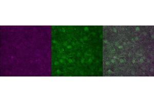 Immunohistochemistry (IHC) image for anti-Protein Phosphatase 1, Regulatory (Inhibitor) Subunit 1B (PPP1R1B) antibody (ABIN7456009) (DARPP32 antibody)