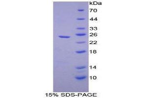 SDS-PAGE (SDS) image for Chymotrypsin-Like Elastase Family, Member 1 (CELA1) (AA 44-259) protein (His tag) (ABIN2120984)