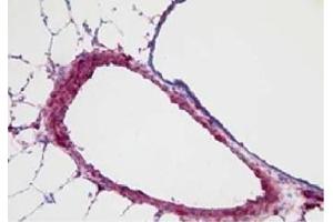 Frozen mouse lung tissue section following 21 days of hypoxia was stained with anti-S100A4 followed by Goat Anti-Rabbit IgG(H+L), Mouse/Human ads-UNLB (Goat anti-Rabbit IgG (Heavy & Light Chain) Antibody)