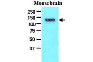 The extracts of mouse brain (50 ug) were resolved by SDS-PAGE, transferred to NC membrane and probed with EPHA2 monoclonal antibody, clone 3D7  (1:500).