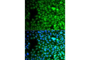 Immunofluorescence analysis of A549 cells using ZNF195 antibody (ABIN4905676). (ZNF195 antibody)