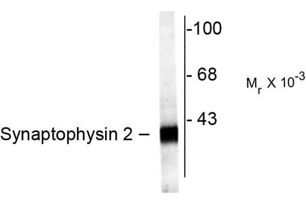 Synaptoporin antibody  (C-Term)