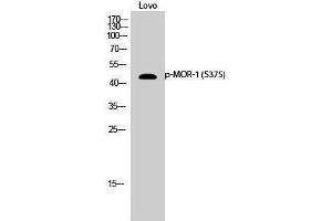 Western Blotting (WB) image for anti-Opioid Receptor, mu 1 (OPRM1) (pSer375) antibody (ABIN3182830) (Mu Opioid Receptor 1 antibody  (pSer375))