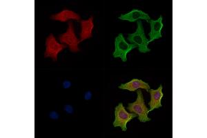 ABIN6258925 and ABIN6274995 staining Hela cells by IF/ICC. (CBLN2 antibody  (N-Term))