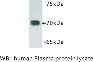 Image no. 1 for anti-Complement C3 beta Chain (C3b) antibody (ABIN1112803) (Complement C3b antibody)