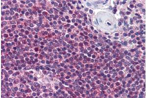 Human Spleen (formalin-fixed, paraffin-embedded) stained with NIACR2 antibody ABIN290337 at 10 ug/ml followed by biotinylated goat anti-rabbit IgG secondary antibody ABIN481713, alkaline phosphatase-streptavidin and chromogen. (GPR109B antibody  (AA 1-50))