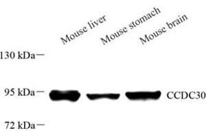 Western blot analysis of CCDC30 (ABIN7073536) at dilution of 1: 500 (CCDC30 antibody)