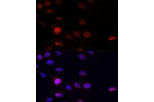 Immunofluorescence analysis of C6 cells using KLHL8 antibody (ABIN7268081) at dilution of 1:100. (KLHL8 antibody  (AA 271-620))
