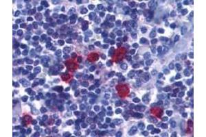 Immunohistochemistry of BAFF Receptor in human tonsil tissue with BAFF Receptor antibody at 5 μg/ml. (TNFRSF13C antibody  (C-Term))