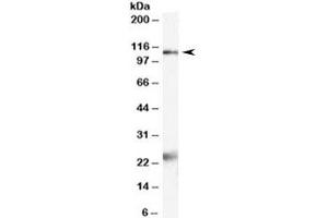 Western blot testing of rat brain lysate with NR1 antibody at 2ug/ml. (GRIN1/NMDAR1 antibody)
