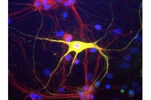 Immunostaining of cultured rat neurons and glia showing peripherin in green and alpha-internexin in red. (Peripherin antibody)