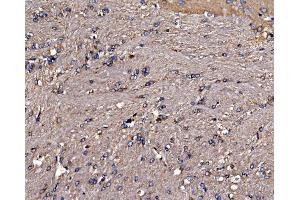 IHC analysis of Gephyrin/GPHN using anti-Gephyrin/GPHN antibody (ABIN7600086).