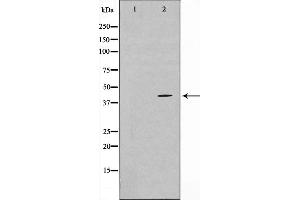 Western blot analysis on COLO205 cell lysate using TBX1 Antibody. (T-Box 1 antibody  (C-Term))